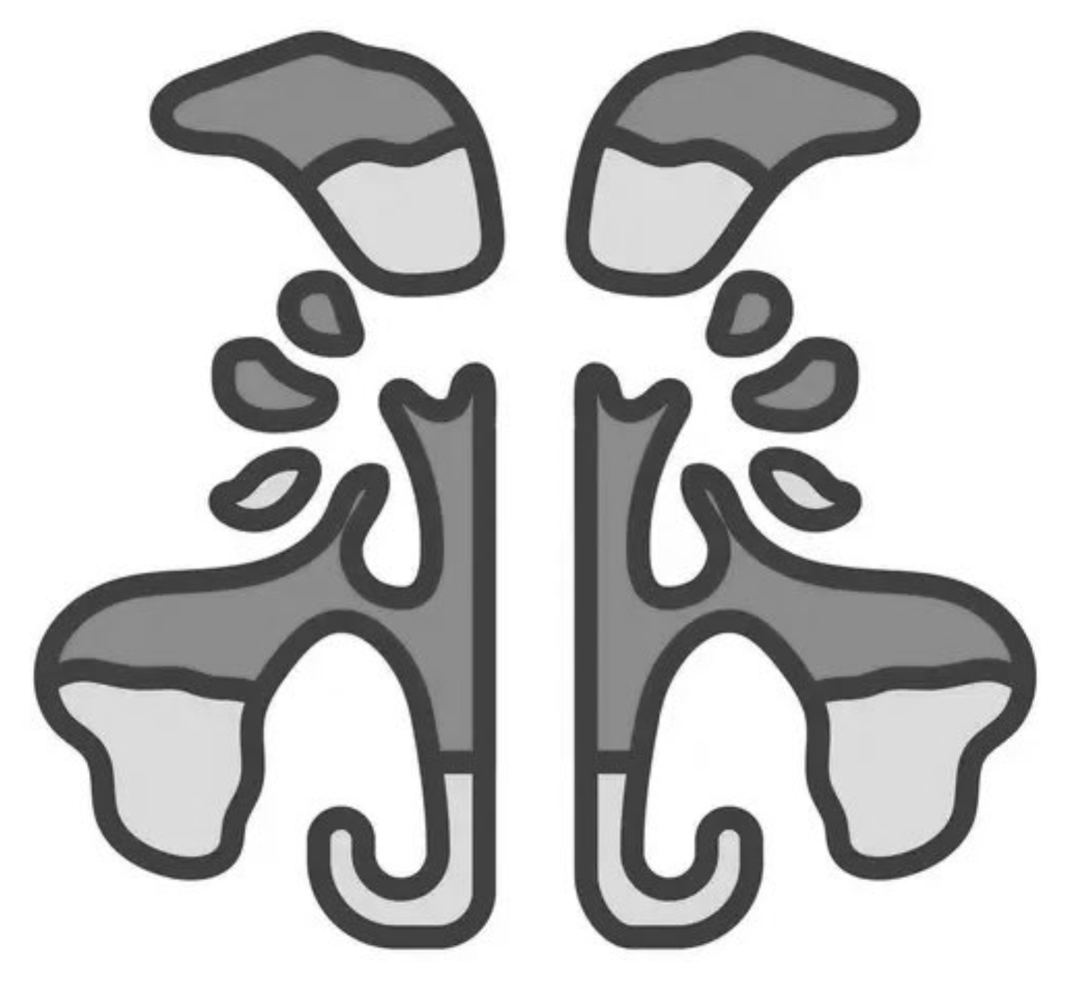 Chronic Sinusitis and Sinus Surgery (FESS)